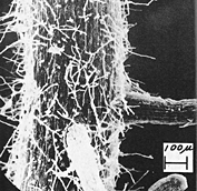 水稲幼植物根の走査型電子顕微鏡写真　腐植添加区